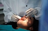 Ozempic teeth: Dentists warn of new GLP-1 side effect