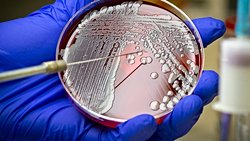 Et Yiyen Bakteri Hastalığı