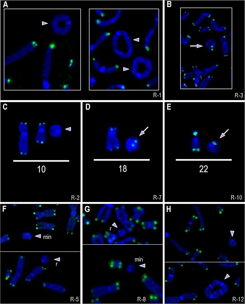 FISH ile incelenen büyük bir halka kromozom vakası. Telomerik sinyalleri olmayan halka kromozomları ok başlarıyla; sinyalli olanlar oklarla (b, d ve e) vurgulanmıştır.