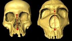 Burun Şeklimiz Bize Neandertal'lerden Miras Kalmış Olabilir!