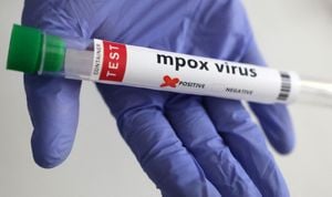 Morocco Leads Africa With Mpox Testing Initiative