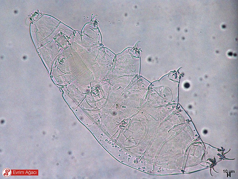 Söz konusu örneklediğimiz birey.