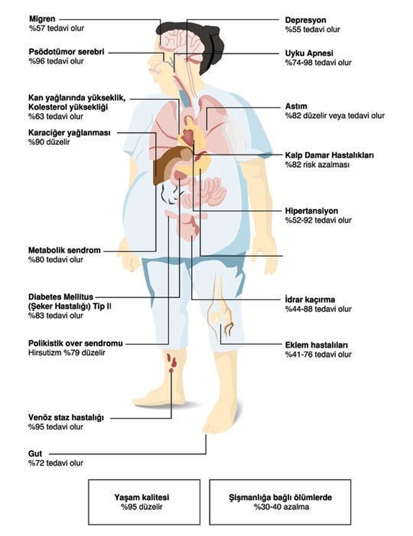 Obezitenin tedavi edilmesiyle neden olduğu hastalıkların ortadan kalkma oranı.