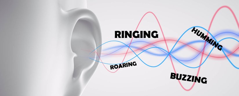 Tinnitus (Kulak Çınlaması)