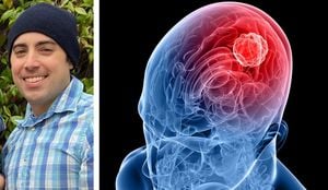 Urgent Call For Improved Brain Cancer Support And Funding