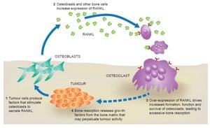 Novel Regulator P15Ink4b Identified As Key Player In Osteoclast Differentiation