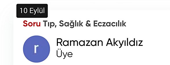 Bu soru 10 Eylül 2021'de sorulmuş.