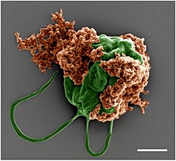 Yüzen Mikrorobotlar Farelerde Kanserli Hücrelerle Savaşıyor!