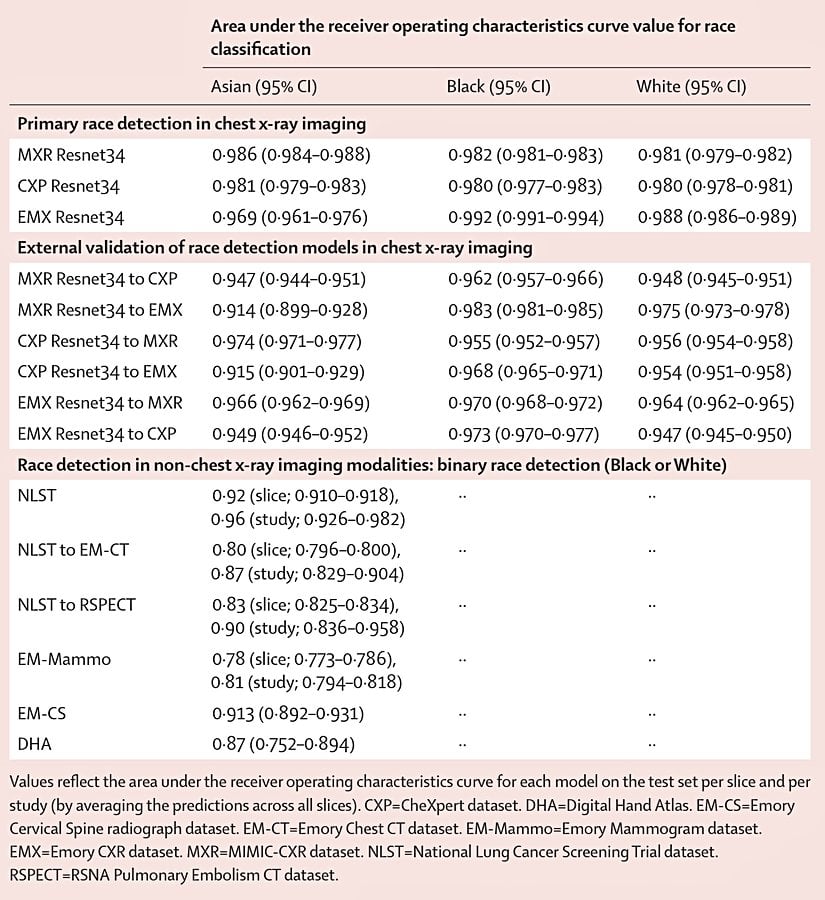Yapay zekanın ırk teşhisindeki başarı oranları. Sayılar 0 ve 1 arasında değerler almaktadır.