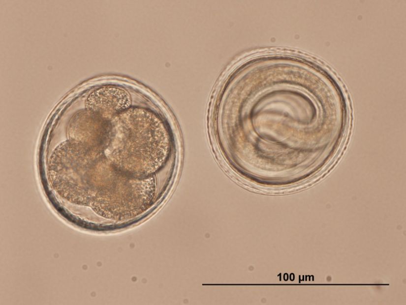 Roundworm Toxocara Yumurtası (Yuvarlak Solucan)
