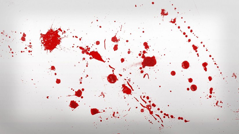 Domuzlar Üzerinde "Dexter" Deneyleri: Kurşun Giriş Noktasında Kan Nasıl Sıçrıyor?
