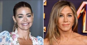 Denise Richards Tries Salmon Sperm Facial Inspired By Aniston