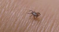 Tick season has arrived in Tennessee. Take these steps to protect yourself