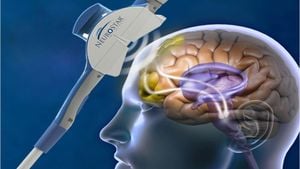 New Hope For Paralysis As Deep Brain Stimulation Restores Walking