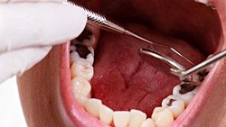 Çok Fazla Diş Fırçalamanın Mikrobiyom Üzerindeki Etkisi ve Beyin Sağlığına Potansiyel Yansımaları