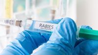 Rabid fox bites Atmore resident, 2 being treated: ADPH | WKRG.com