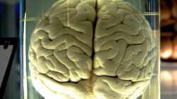 Dorsolateral ve Ventromedial Prefrontal Kortekslerin Asperger Sendromu Üzerindeki Etkileri