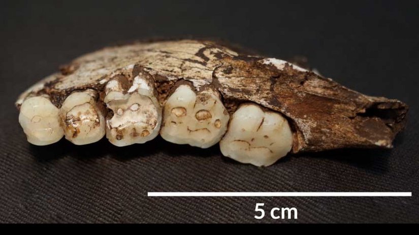 Homo naledi Dişlerindeki Çentikler Bize Ne Anlatıyor?