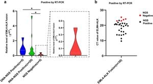 Advanced Sequencing Enhances ALK Fusion Detection For Lung Cancer