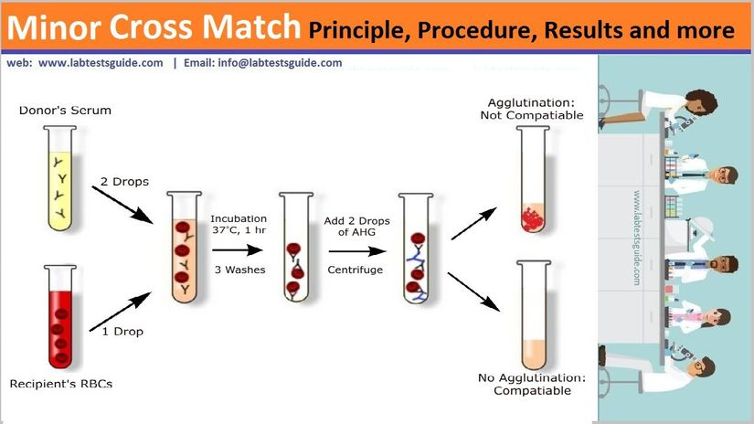 Cross matching (çapraz karşılaştırma)
