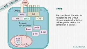 New Study Unveils WNT Pathway Activation Linked To Focal Cortical Dysplasia