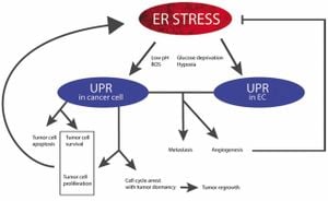 New Unfolded Protein Response Signature Predicts AML Patient Outcomes