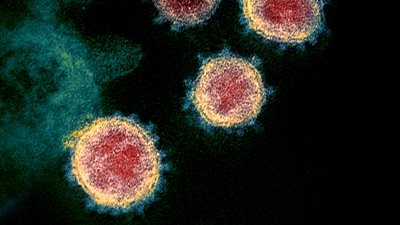 Bir Hastalığın Temel Bulaşıcılık ve Üreme Katsayısı (R0 Değeri) Nedir? Nasıl Hesaplanır?