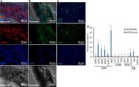 Involvement of tdTomato-Tagged RPE cells in a mouse PVR model with enzymatically compromised retina - Scientific Reports