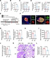 Endocrine-exocrine miR-503-322 drives aging-associated pancreatitis via targeting MKNK1 in acinar cells - Nature Communications