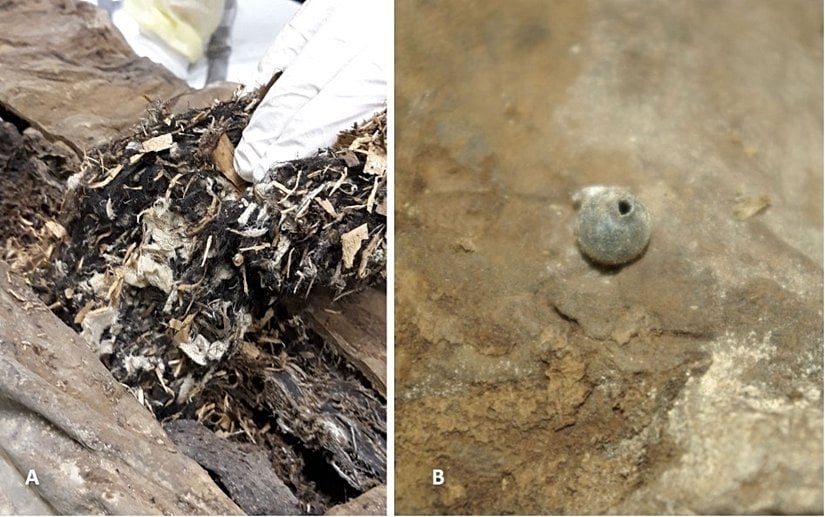 A: Karın dorsal duvarından çıkarılan yabancı materyal karışımı beyaz kumaş, küçük talaş parçaları ve bitkisel materyaller ile bazı kahverengi amorf doku kalıntıları içeriyor.   B: Sol pelviste bulunan cam kürede kenarları çıkıntılı bir delik var.   Görsel: Andreas Nerlich