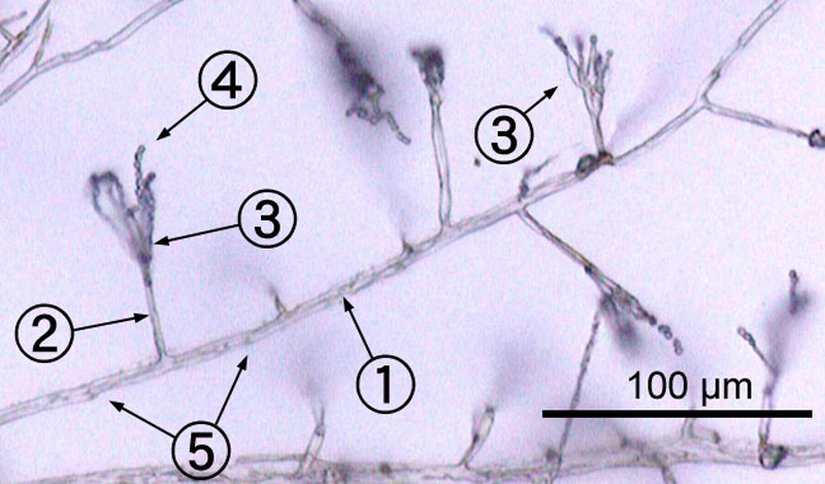 An Environmental Isolate of Penicillium (type of mold)     1. hypha 2. conidiophore 3. phialide 4. conidia 5. septa