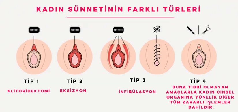 Dünya Sağlık Örgütü’nün Açıklamış Olduğu KGM Tiplerinin Figürleri (Çeviren: Ali Ahmet Turunç)