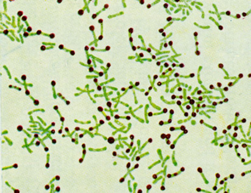 Difteriye neden olan Corynebacterium türü...