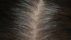 Saçlarımız Neden Beyazlar?