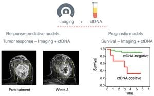 Revolutionary CtDNA Testing Enhances Early Breast Cancer Treatment