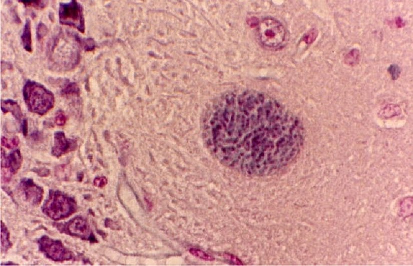 Işık mikroskobu altında Toxoplasma gondii doku kistleri