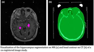 Imaging Tools Reveal Critical Roles Of Dendritic Stability