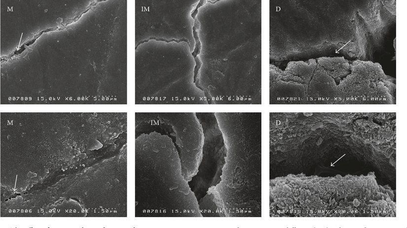 Malzemelerde oluşan, gözle görülmez mikro kırıkların mikroskop altında görüntüsü.