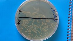 Rekombinant Plazmit Transformasyonu Nedir? Ve Nasıl Yapılır?