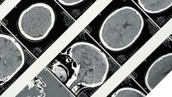 Davranışsal Özelliklerin Nöroanatomik İncelenmesi