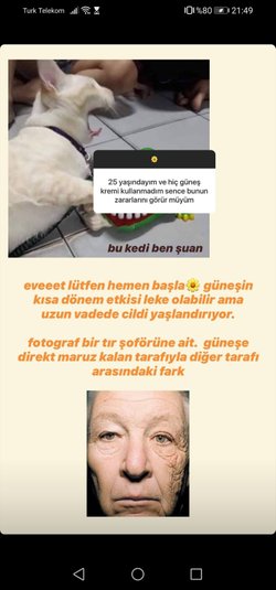 Güneşe maruz kalındığında güneş kremi kullanılmasa uzun vadede cildi yaşlandırır mı?