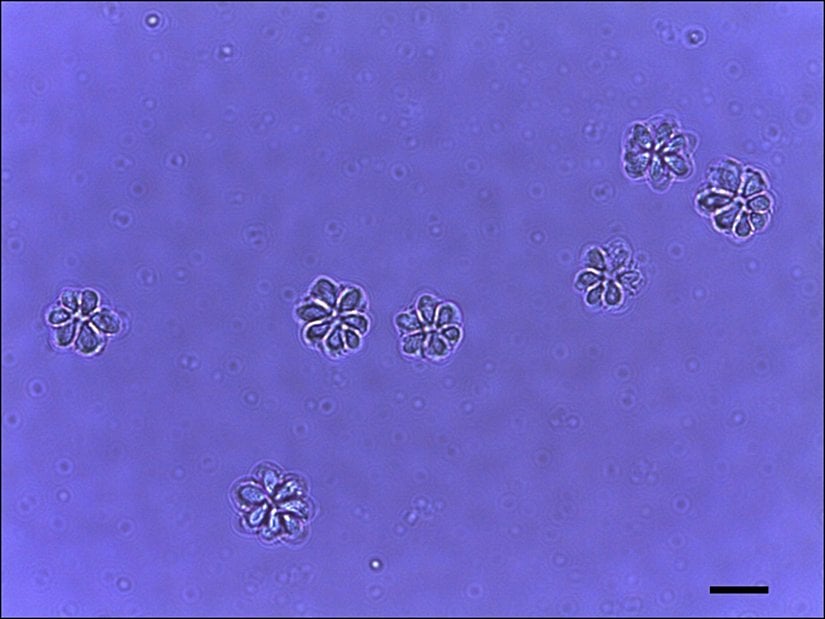 Myxosporea üyelerinden biri olan Kudoa septempunctata türünün sporları.