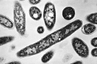 New York City records fifth death in Legionnaires’ outbreak