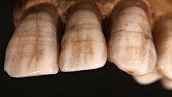 Tarihöncesi İnsan Dişleri, Gerçek "Paleo Diyeti"nde Tahıl Ürünleri Olduğunu da Gösteriyor!
