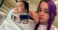 British woman, 29, injured with mysterious black eye in South Korea