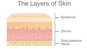 Epidermis