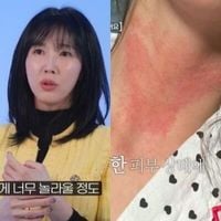 이수경, 우울증→대인기피증 고백 