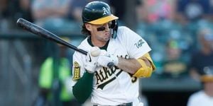 Athletics Shortstop Jacob Wilson Faces Hand Injury Scare
