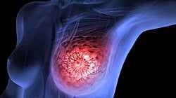 Mutlak Risk ve Göreli Risk Nedir? Yüzdelik Değişimler Ne Anlama Geliyor?