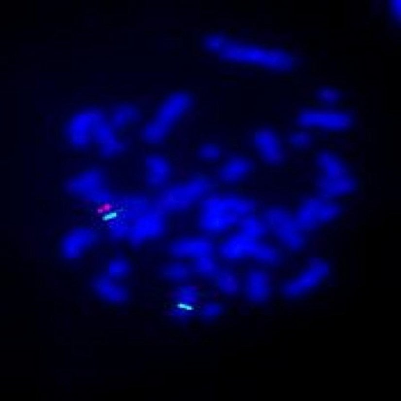 In situ Hibridizasyon tekniği ile incelenen genler. İki yeşil, 2 sentromer X kromozomunu ve bir kırmızı Xpterdeki (X kromozomunun kısa kolundaki terminal bölge.) SRY'yi  gösterir. Sarı (üst üste gelen kırmızı ve yeşil) noktanın olmaması, Y kromozomu sentromerlerinin olmadığını gösterir.